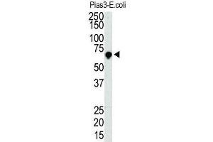 Western Blotting (WB) image for anti-Protein Inhibitor of Activated STAT, 3 (PIAS3) antibody (ABIN5016360) (PIAS3 anticorps)