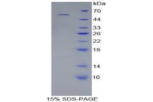 SDS-PAGE (SDS) image for Collagen, Type IV, alpha 3 (COL4A3) (AA 1428-1670) protein (His tag,GST tag) (ABIN1879745)