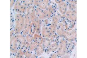 IHC-P analysis of Rat Tissue, with DAB staining. (CUBN anticorps  (AA 3157-3274))