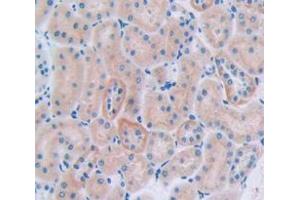 IHC-P analysis of Rat Tissue, with DAB staining. (CUBN anticorps  (AA 3157-3274))