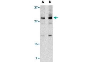 Western blot analysis of Klra2 in mouse spleen tissue lysate with Klra2 polyclonal antibody  at (A) 0. (Klra2 anticorps  (C-Term))