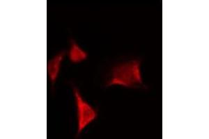 ABIN6269252 staining Hela by IF/ICC.