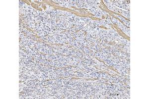 IHC analysis of MT-ND5 using anti-MT-ND5 antibody (ABIN7600145). (MT-ND5 anticorps  (AA 154-570))