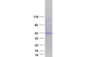 Validation with Western Blot