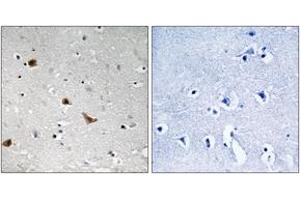 Immunohistochemistry analysis of paraffin-embedded human brain, using IKK-gamma (Phospho-Ser376) Antibody. (IKBKG anticorps  (pSer376))