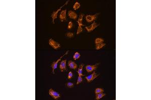 Immunofluorescence analysis of U2OS cells using TRH Rabbit pAb (ABIN7270826) at dilution of 1:100.