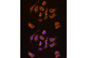 Immunofluorescence analysis of U2OS cells using TRH Rabbit pAb (ABIN7270826) at dilution of 1:100. (TRH anticorps  (AA 100-200))