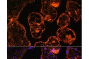 Immunofluorescence analysis of Human placenta cells using LDB3 Polyclonal Antibody at dilution of 1:100. (LIM Domain Binding 3 Protein anticorps)