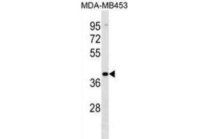 Western Blotting (WB) image for anti-Vomeronasal 1 Receptor 2 (VN1R2) antibody (ABIN3000165)