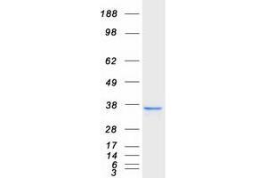 Validation with Western Blot