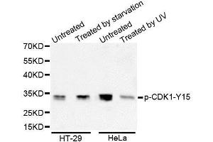 Western Blotting (WB) image for anti-Cyclin-Dependent Kinase 1 (CDK1) (pTyr15) antibody (ABIN6225371) (CDK1 anticorps  (pTyr15))