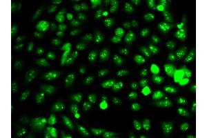 Immunofluorescence analysis of HeLa cell using IDH1 antibody. (IDH1 anticorps  (AA 1-414))