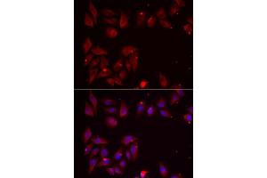 Immunofluorescence analysis of U2OS cells using PDXK antibody. (PDXK anticorps  (AA 1-312))