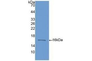Detection of Recombinant BMP6, Rat using Polyclonal Antibody to Bone Morphogenetic Protein 6 (BMP6)