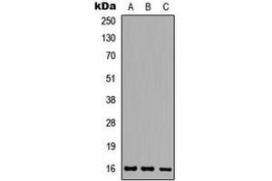 Western blot analysis of Ataxin 7L1 expression in HeLa (A), Raw264. (ATXN7L1 anticorps  (Center))