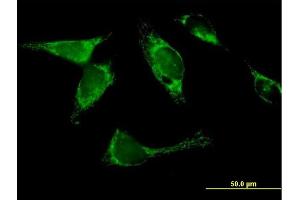 Immunofluorescence of  purified  MaxPab antibody to YARS2 on HeLa cell.