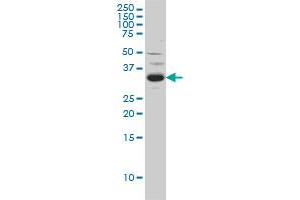 SPRY2 monoclonal antibody (M01), clone 1E10 Western Blot analysis of SPRY2 expression in C32 .