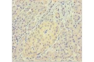 Immunohistochemistry of paraffin-embedded human pancreatic tissue using ABIN7165325 at dilution of 1:100 (LMAN1L anticorps  (AA 26-462))