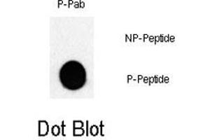 Dot blot analysis of JUN (phospho T243) polyclonal antibody  on nitrocellulose membrane.