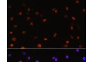 Immunofluorescence analysis of C6 cells using COPS5 Polyclonal Antibody at dilution of 1:100. (COPS5 anticorps)
