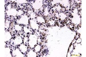 FOXP2 polyclonal antibody  staining formalin-fixed paraffin-embedded mouse lung tissue (10 ug/mL).