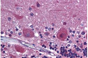 Human Brain, Cerebellum: Formalin-Fixed, Paraffin-Embedded (FFPE)