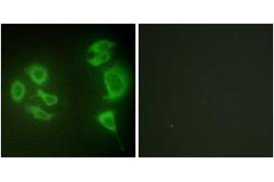 Immunofluorescence analysis of HepG2 cells, using MLTK Antibody. (ZAK anticorps  (AA 701-750))
