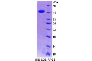 SDS-PAGE analysis of Human TRIP6 Protein. (TRIP6 Protéine)