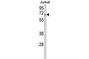 Western blot analysis of RBM14 Antibody (Center) in Jurkat cell line lysates (35ug/lane). (RBM14 anticorps  (Middle Region))