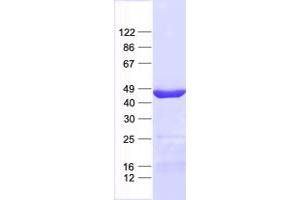 Validation with Western Blot