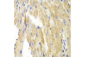 Immunohistochemistry of paraffin-embedded mouse heart using KRT19 antibody at dilution of 1:100 (400x lens). (Cytokeratin 19 anticorps)