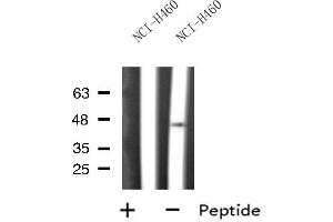 Western blot analysis of PDHA2 expression in NCI-H460 cell line lysates,The lane on the left is treated with the antigen-specific peptide. (PDHA2 anticorps  (C-Term))
