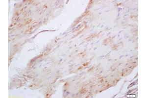 Formalin-fixed and paraffin embedded mouse stomach labeled with Anti-Elastin Polyclonal Antibody, Unconjugated (ABIN1386226) at 1:200 followed by conjugation to the secondary antibody and DAB staining (Elastin anticorps  (AA 101-200))