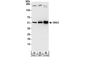 anti-Spindle and Kinetochore Associated Complex Subunit 3 (SKA3) (AA 362-412) antibody