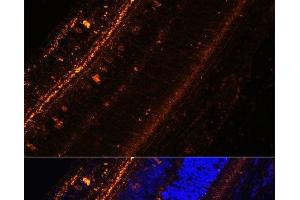 Immunofluorescence analysis of Rat eye using KCNS2 Polyclonal Antibody at dilution of 1:100 (40x lens).