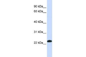 WB Suggested Anti-CAV2 Antibody Titration:  0. (Caveolin 2 anticorps  (N-Term))
