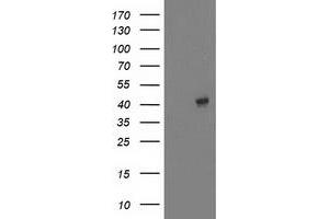 Western Blotting (WB) image for anti-Microtubule-Associated Protein, RP/EB Family, Member 2 (MAPRE2) antibody (ABIN1499320) (MAPRE2 anticorps)
