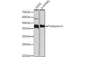 Western blot analysis of extracts of various cell lines, using Podoplanin Rabbit mAb (ABIN7269430) at 1:1000 dilution. (Podoplanin anticorps)