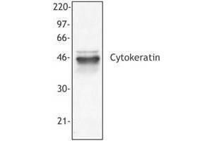 Image no. 1 for anti-pan Keratin (panKRT) antibody (ABIN293953) (pan Keratin anticorps)