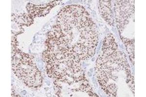 Immunohistochemistry (IHC) image for anti-TAR DNA Binding Protein (TARDBP) (AA 1-260), (N-Term) antibody (ABIN317572)