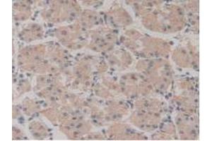 IHC-P analysis of Human Stomach Tissue, with DAB staining. (NUP210 anticorps  (AA 1288-1449))