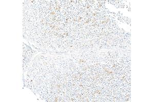 Immunohistochemistry (IHC) image for anti-Interferon gamma (IFNG) (AA 23-166) antibody (ABIN7795707)