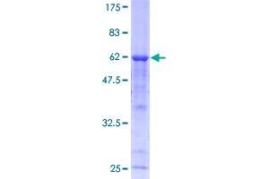 Image no. 1 for Calpain 3 (CAPN3) (AA 1-309) protein (GST tag) (ABIN1347990)