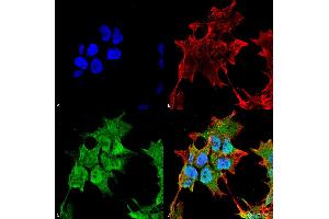 Immunocytochemistry/Immunofluorescence analysis using Mouse Anti-SUR1 Monoclonal Antibody, Clone S289-16 . (ABCC8 anticorps  (AA 1548-1582) (Biotin))