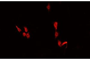 ABIN6266478 staining U-2 OS cells by IF/ICC. (CEBPE anticorps  (Internal Region))