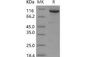Melanotransferrin (MELTF) protein (Fc Tag)