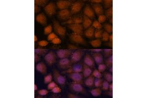 Immunofluorescence analysis of HeLa cells using CEP85 antibody (ABIN7266281) at dilution of 1:100. (CEP85 anticorps  (AA 130-430))