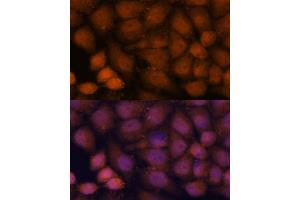 Immunofluorescence analysis of HeLa cells using CEP85 antibody (ABIN7266281) at dilution of 1:100.