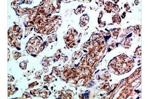 Immunohistochemical analysis of paraffin-embedded Human-placenta, antibody was diluted at 1:100 (BMPR1B anticorps  (AA 21-70))