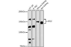 Western blot analysis of extracts of various cell lines, using IRS2 antibody (ABIN6128094, ABIN6142544, ABIN6142545 and ABIN6223949) at 1:500 dilution. (IRS2 anticorps  (AA 510-650))